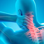 Lifestyle and Neck Pain